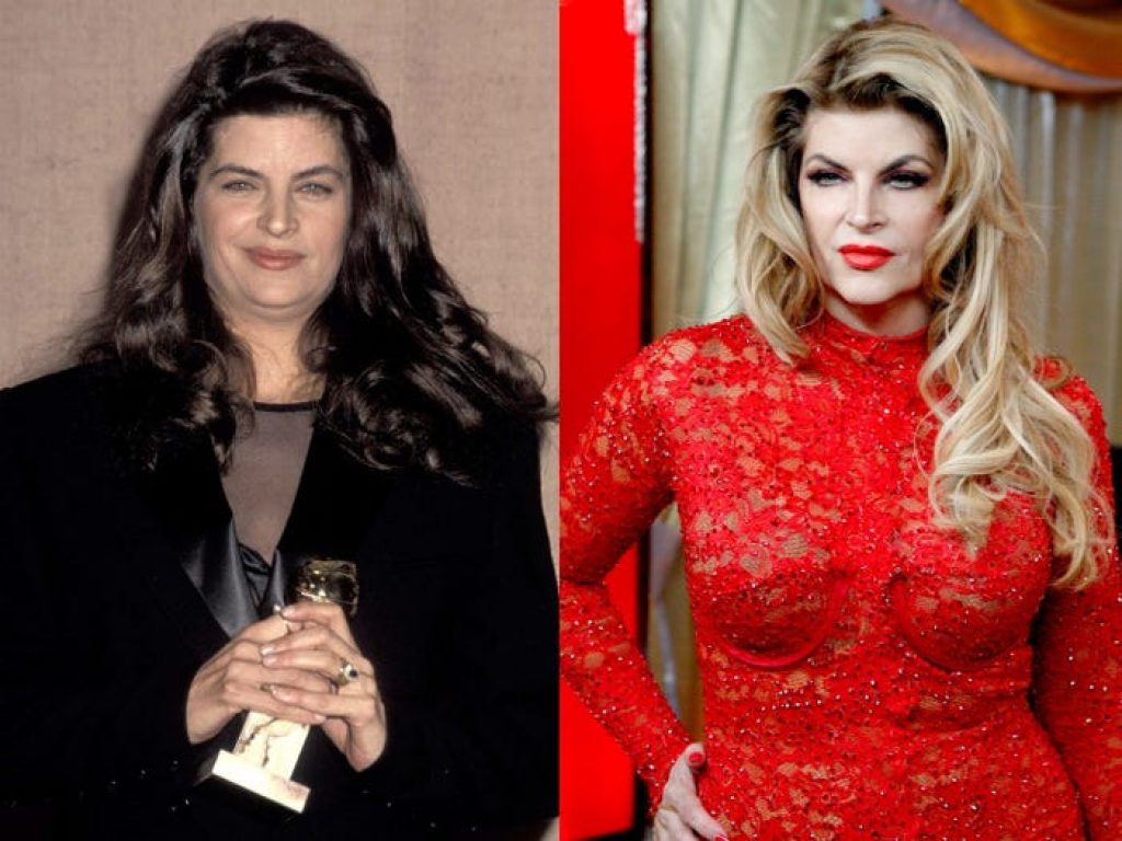 Kristie Alley's Weight Loss Transformation